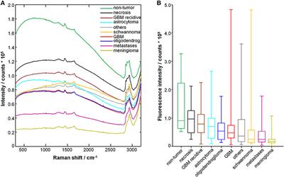 Rapid Label-Free Analysis of Brain Tumor Biopsies by Near Infrared Raman and Fluorescence Spectroscopy—A Study of 209 Patients